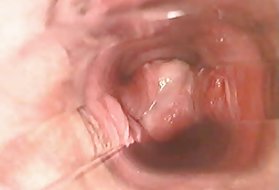 Fuck hairy pussy, anal sex mit anal-creampie ficken Pornos im web strapona Mann