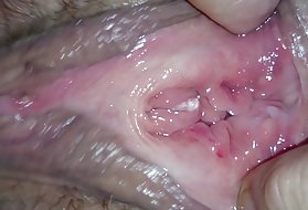Extreme innere schließen und sprühen das extreme extreme close ruparel